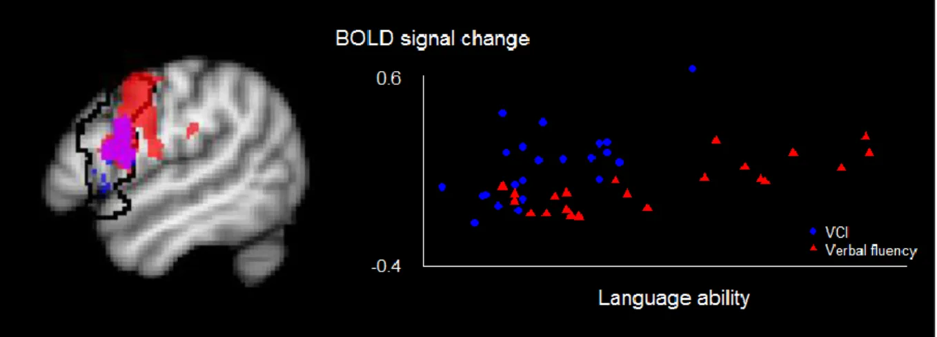 Figure 3. Correlations between language ability and BOLD responses to phonological processing