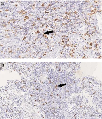 Table 2 Correlations between expression of LIGHT and its receptors (HVEM and LTbR) and severity of ﬁbrosis and other demographic and clinical features