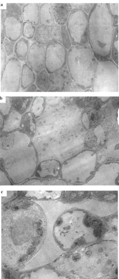 Fig. 1. Electron microscopy image of cells of ryegrass seedat magnification 1: 2 200 – seedlings treated in an electric field with intensity of: a – E = 2.7 105 V m-1, t = 3 s (treatment B2);b – E = 3.6 105 V m-1, t = 3 s (treatment B3); c – untreated (treat-ment B1 control).