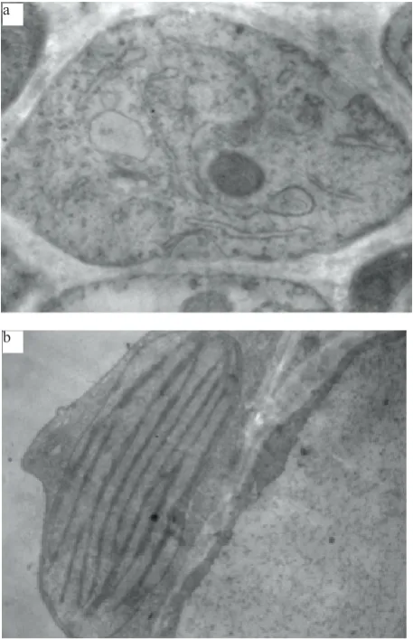 Fig. 5. Electron microscopy image of cells of ryegrass seedfield with intensity of: a – E = 2.7 10 at magnification of 1: 11 000 seedlings of treated in an electric 5 V m-1, t = 3 s (treatment B2); b – untreated (treatment B1 control).