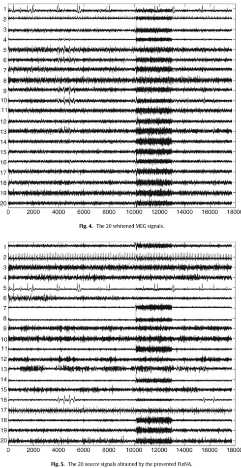 Fig. 4. The 20 whitened MEG signals.