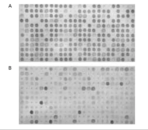 Fig. 1. Construction and identification of SSH library. A. Total RNA quality assay.  B