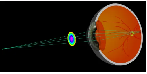 Figure 4. Example of a collected wavefront for an eye with myopia.