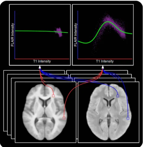 Fig. 5. Transfer functions computed to map synthetic FLAIR images to their corresponding training FLAIR images