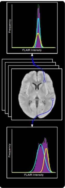 Fig. 8. An overview of the process of creating the L SYN and L FLAIR likelihood maps.