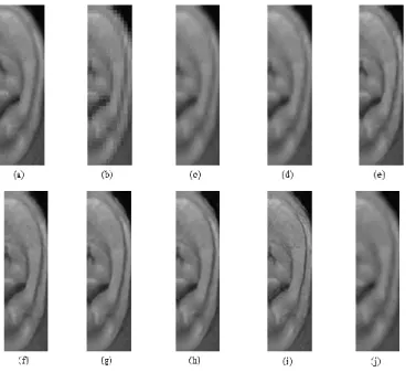Fig. 3.  Original  high  resolution  image  and  its  enlarged  high  resolution  images: (a) high-resolution input ear image, (b) nearest neighbor, (c) bilinear  interpolation,  (d) bicubic interpolation, (e)  SRCNN,  (f) SCN,  (g) VDSR,  (h)  DRRN, (i)  