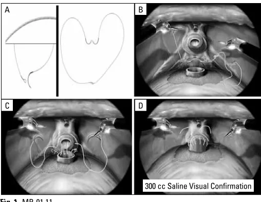 Fig. 1. MP-01.11