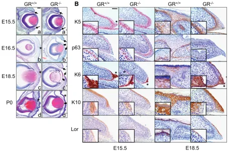 Fig. 1. Delayed and impaired eyelid closure in glucocorticoid receptor (GR) null mice