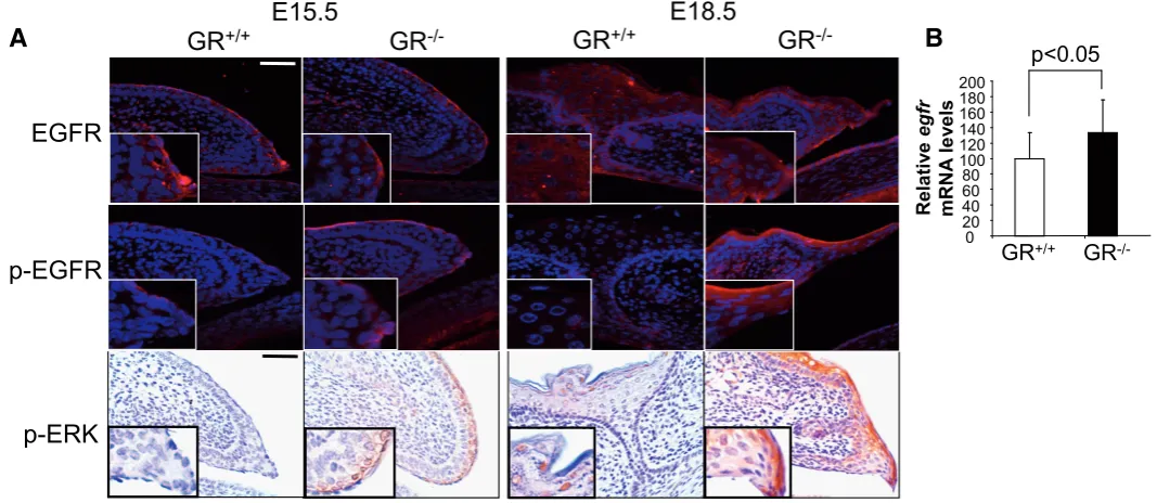 Fig. 3. Glucocorticoid receptor (GR) interferes with EGFR-mediated signaling during eyelid development