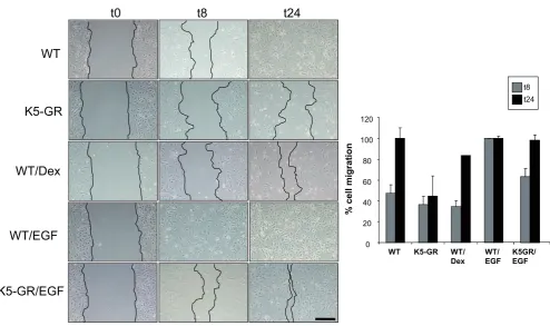 Fig. 4. Glucocorticoid receptor (GR) delays keratinocyte migration in in vitro wound scratch assays