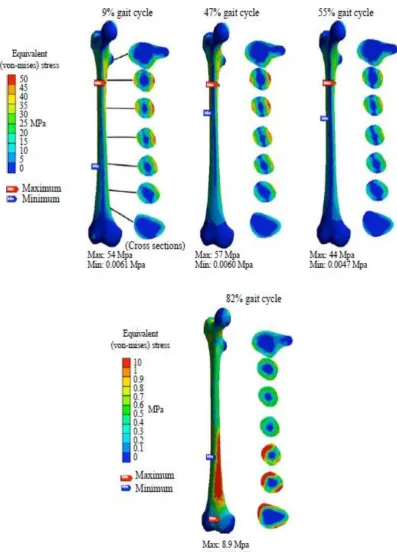 Figure 1. 4: Von Mises stress distribution inner and outer of the femur 
