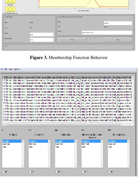 Figure 2. FIS Editor Tipe Sugeno 