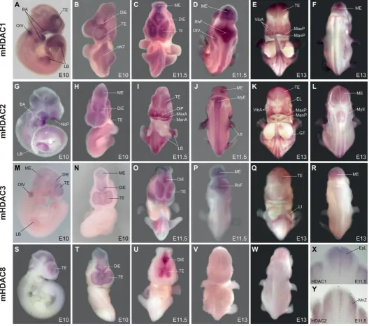 Fig. 5. Class I HDAC expression during mouse development. Mouse embryos at E10, E11.5 and E13 days of embryonic development werein region are also strongly positive from E11.5 embryos tubercle
