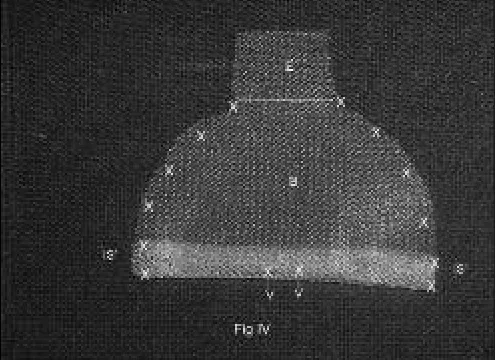 Fig. 1. P45.