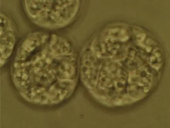 Fig. 1. Photomicrograph of the micro-algae Crypthecodinium cohnii courtesy of Casey Lippmeier of DSM Nutritional Products and David L.Spector of Cold Spring Harbor Laboratory, Laurel Hollow, NY, USA respectively.