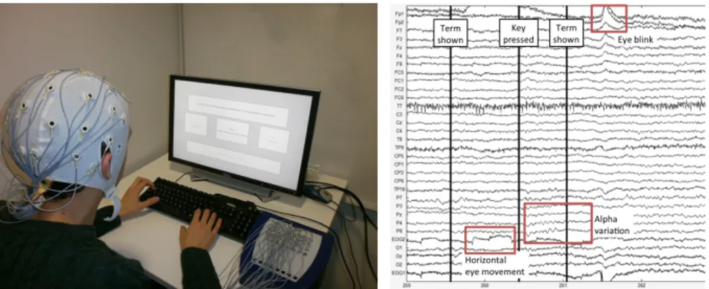 Figure 2.3: Example of EEG recording from Publication III.