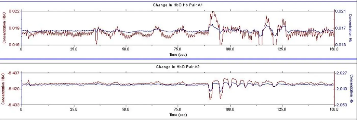 Figure 1.—Relative hemoglobin concentrations over time showing motion artefact and physiological noise