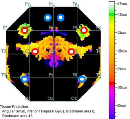 Figure 4.—Tissue projections ††  with respect to the 10-20 locations are  shown. Eight measurement locations (source-detector pair midpoints) are  shown schematically with cortex to be interrogated beneath the marked  circles