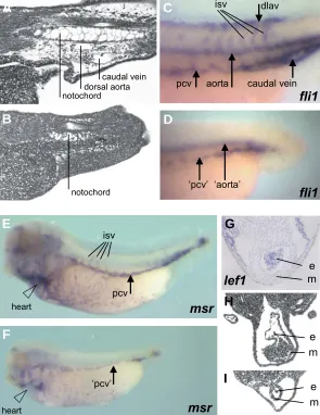 Fig. 5. The cardiovascular system is affected by lef1 depletion. Sagittal sectionexpression ofcardinal vein