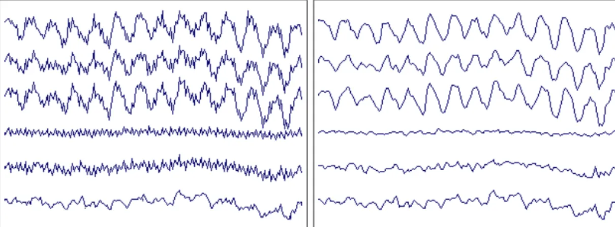 Figure 5.2: 50Hz noise in the EEG signal and the same signal after processing with a notch-filter.