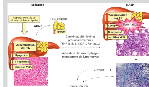 Figure 1. De la stNASH s’accompagne de l’activation de cellules immunitaires prune augmentation de la lipogenlipidique : une captation excessive des acides gras libres produits par la lipolyse au niveau du tissu adipeux, une accumulation de triglycdcytopla