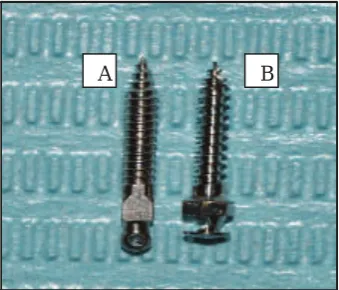 Table 1: Description of mini-implants used in this study with division groups.  