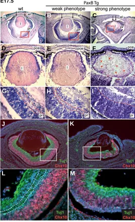Fig. 3. Lens and retina defects detected at E17.5 in PaxB transgenic