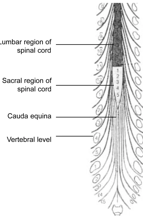 Figure 4). The most common level of disc herniationcausing CES is L4–5, with L5–S1 occurring less fre-