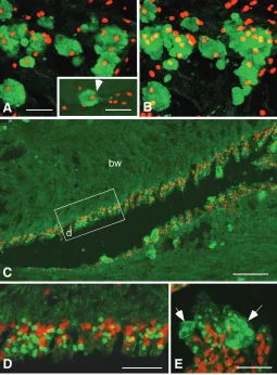 Fig.4A showed multiple nuclei in the granular cells, indicating they
