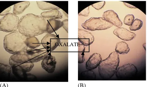 Fig. 2.Microstructure of porang flour (A) before leaching, (B) leaching optimizationprocess using maceration method at magnification 100x  