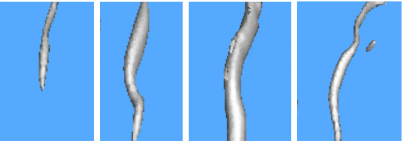 Figure 14.  Three-dimensional perspective of the 8 mb pressure deficit surface as viewed from the southeast  toward the rear flank of the storm