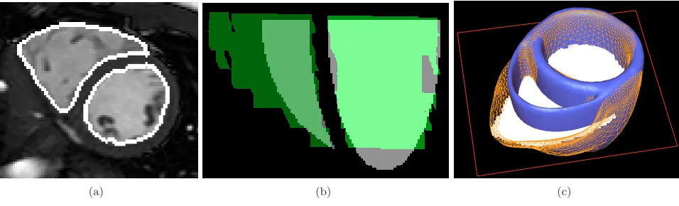 Figure 7. Patient-speciﬁc model three steps: (a) semi-automatic segmentation of the bloodpools (white contours), (b) aﬃne registration between the model blood pools (grey) and thesegmentation (green), (c) local adjustment (orange wire-frame)from the aﬃne transform of themodel (blue surface) using a deformable biomechanical model.