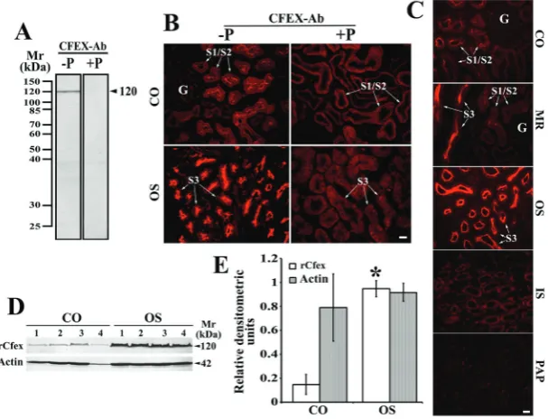 Figure 6 Sex differences in the expression of from the whole male and female kidneys. Shown are means ±SD (n=4 in each group; *isolated from the whole male and female kidneys, with CFEX-Ab and actin-Ab