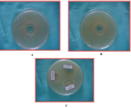 Figure 1: Inhibition zones in relation to: A-Lemon, B-Apple vinegar 