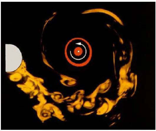 Fig. 4. LIF photograph showing a cross-section in the vertical plane A of the loop vortices shed from asphere wrapping around a columnar vortex.