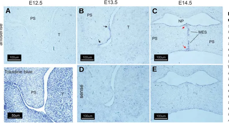 Fig. 1. Expression of Wnt-10a in