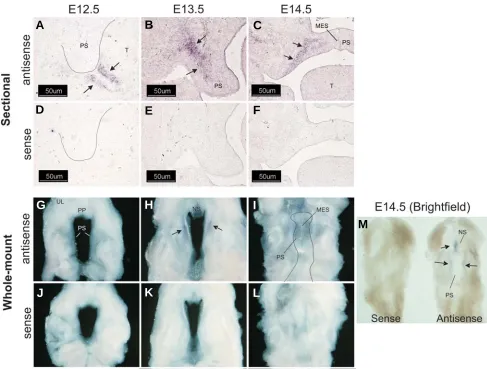 Fig. 3. Wnt-2 is expressed in palatal shelf mesenchyme. Cryostat sections of fixed, frozen heads from mice on days E12.5-E14.5 were processedμfor expression of Wnt-2E14.5