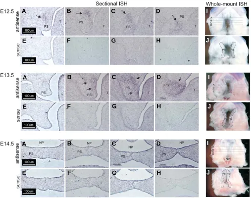 Fig. 5. Whole-mount and sectional in situ hybridization analysis of Wnt-16 expression in the secondary palate