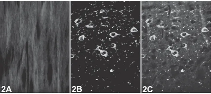 Figure 1  Brain sections were double immunoﬂ uorecence staining with HSP70, αBC and TH in permethrin treatment (group III, 300 mg kg-1) and control group