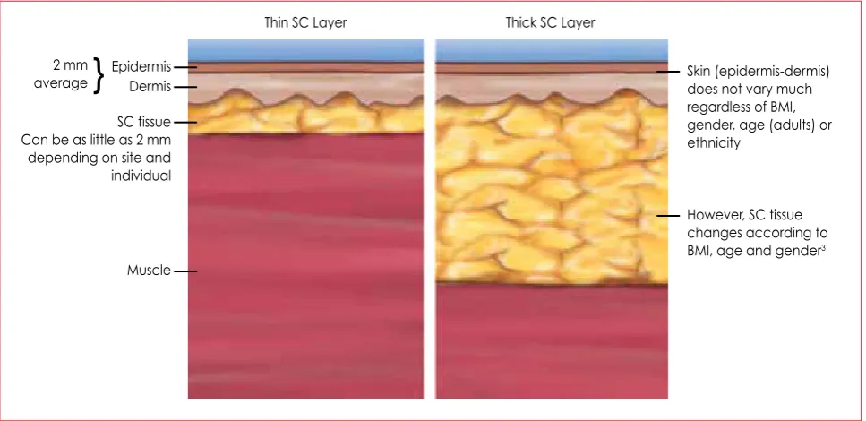 Figure 1: A diagram of the skin and underlying tissue layersBMI: body mass index, SC: subcutaneous