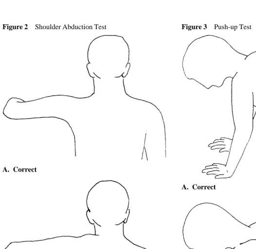 Figure 2Shoulder Abduction Test