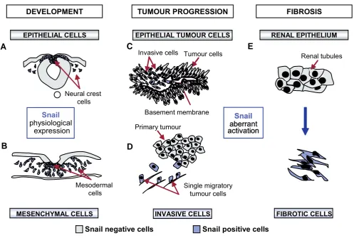 Fig. 1. Snail and the Epithelial-Mesenchymal Transition (EMT) in health and disease. (A,B) The EMT is fundamental for the development of manytissues and organs, including the neural crest and the mesoderm of amniotes