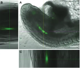 Fig. 2. channels obtained by confocal microscopy. showing the internal location of the fluorescent labeled melanoma cells