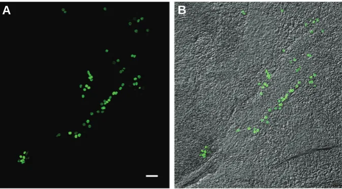 Fig. 3. Squash preparation of a mouse post-implanted embryo colonized by A375-GFP-Np