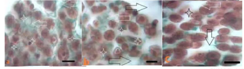 Figure 1. Light photomicrographs of semi thin transverse sections of the Sciatic nerve in the intervention group of 24 (a), 20 Figure 3