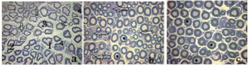 Figure 4.Light photomicrographs of semi thin transverse sections of the sciatic  Light photomicrographs of semi thin transverse sections of the sciatic nerve of Sprague-Dawley male rats in the inter-Figure 2