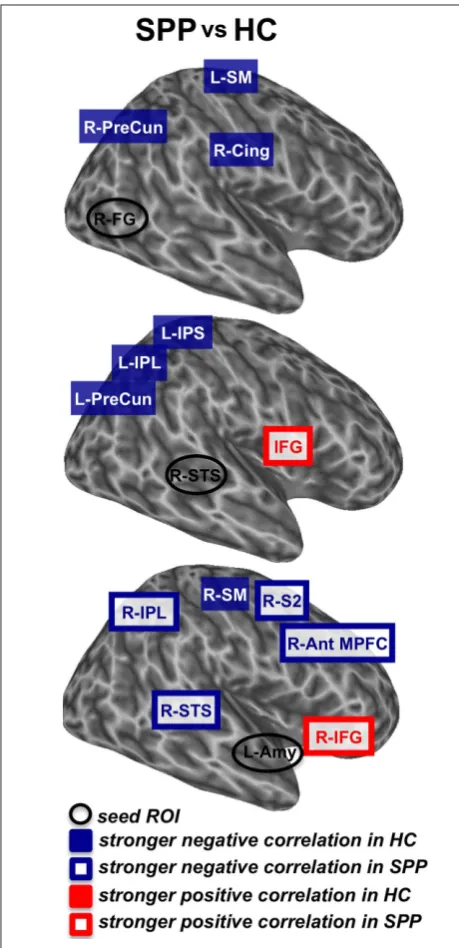 Table 2 | t-score (unpaired t-test; uncorrected P � 0.05) and Talairach–Tournoux Atlas coordinates for the local maxima of brain regions that show signiﬁcant differences in the functional connectivity during face perception between social phobic patients and healthy controls.