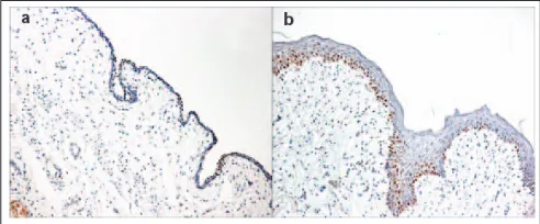 Fig. 5. Representative neuronal nitric oxide synthase (nNOS) staining ofmidurethral cross-sections for placebo-treated (a and c) and estrogen-treated groups (b and d)