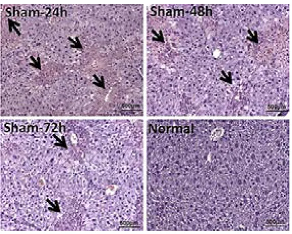 Figure 3. Histological assessment of liver sections in ALF-MSC-Pre and ALF-MSC groups 24, 48, and 72 hours after transplan-tation