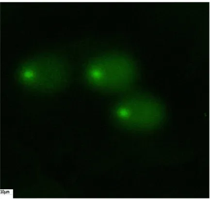 Figure 3. An example of comet assay.